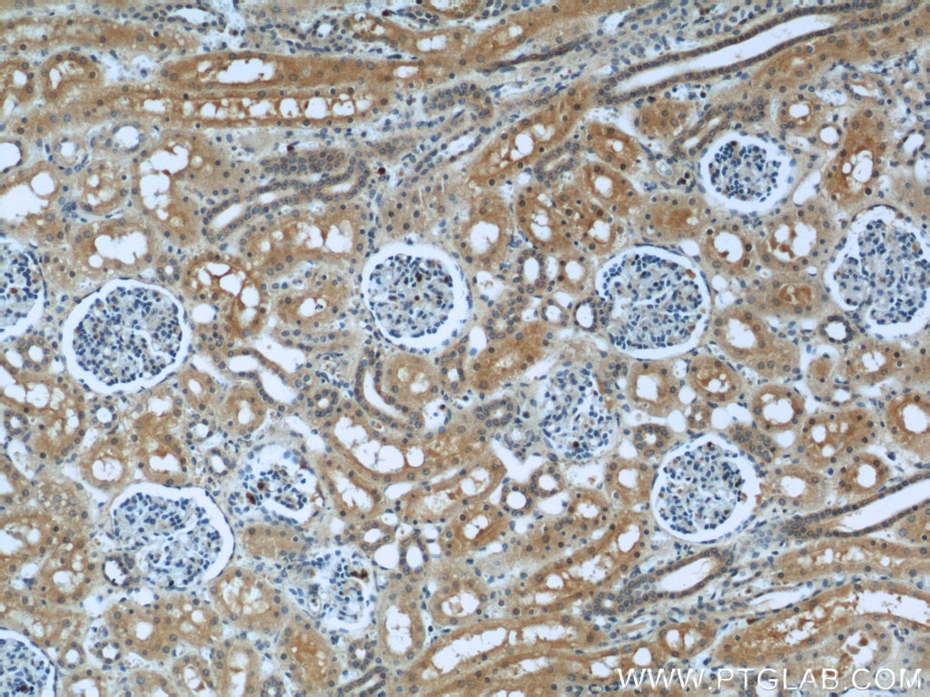 Immunohistochemistry (IHC) staining of human kidney tissue using COL4A3BP Polyclonal antibody (15191-1-AP)