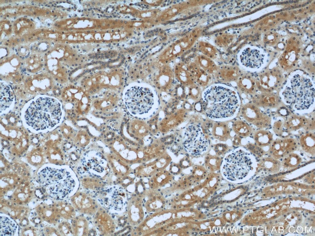 IHC staining of human kidney using 15191-1-AP