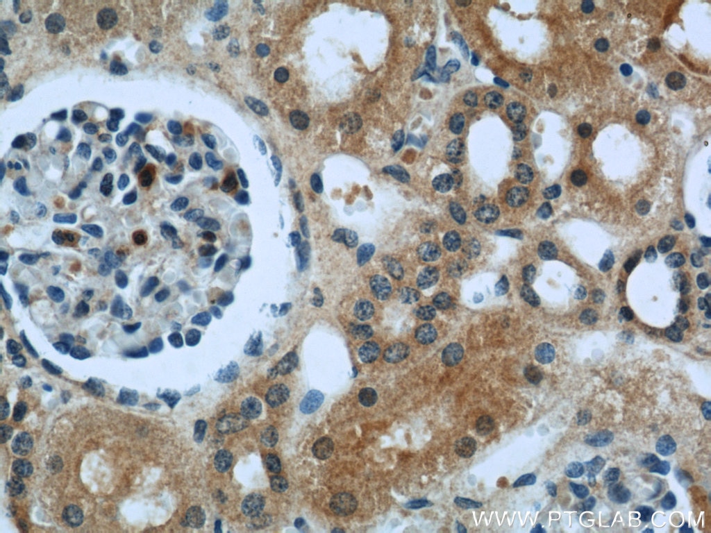 Immunohistochemistry (IHC) staining of human kidney tissue using COL4A3BP Polyclonal antibody (15191-1-AP)