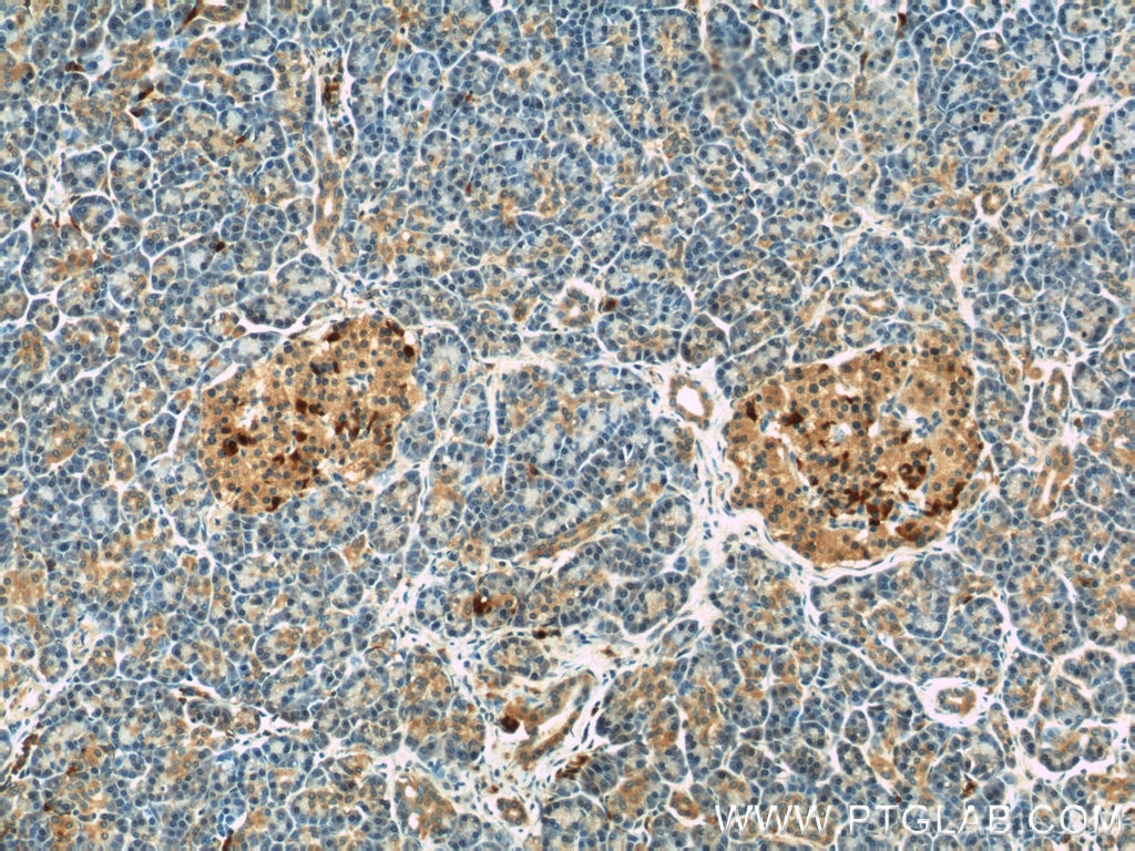 Immunohistochemistry (IHC) staining of human pancreas tissue using COL4A3BP Polyclonal antibody (15191-1-AP)