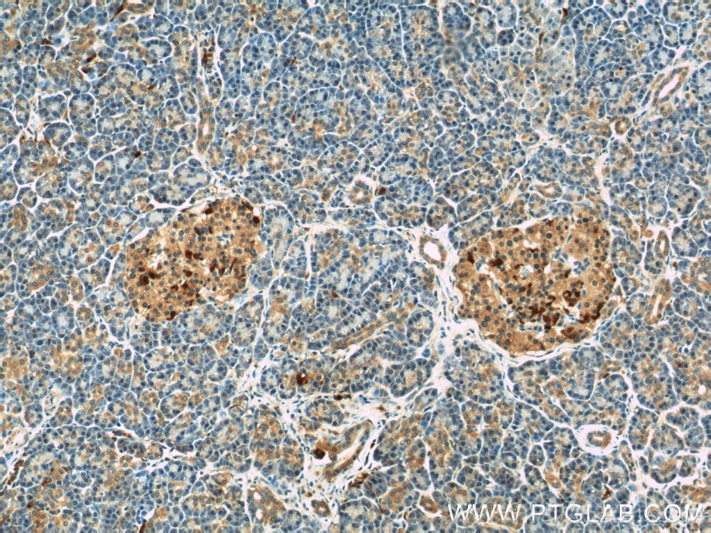 IHC staining of human pancreas using 15191-1-AP