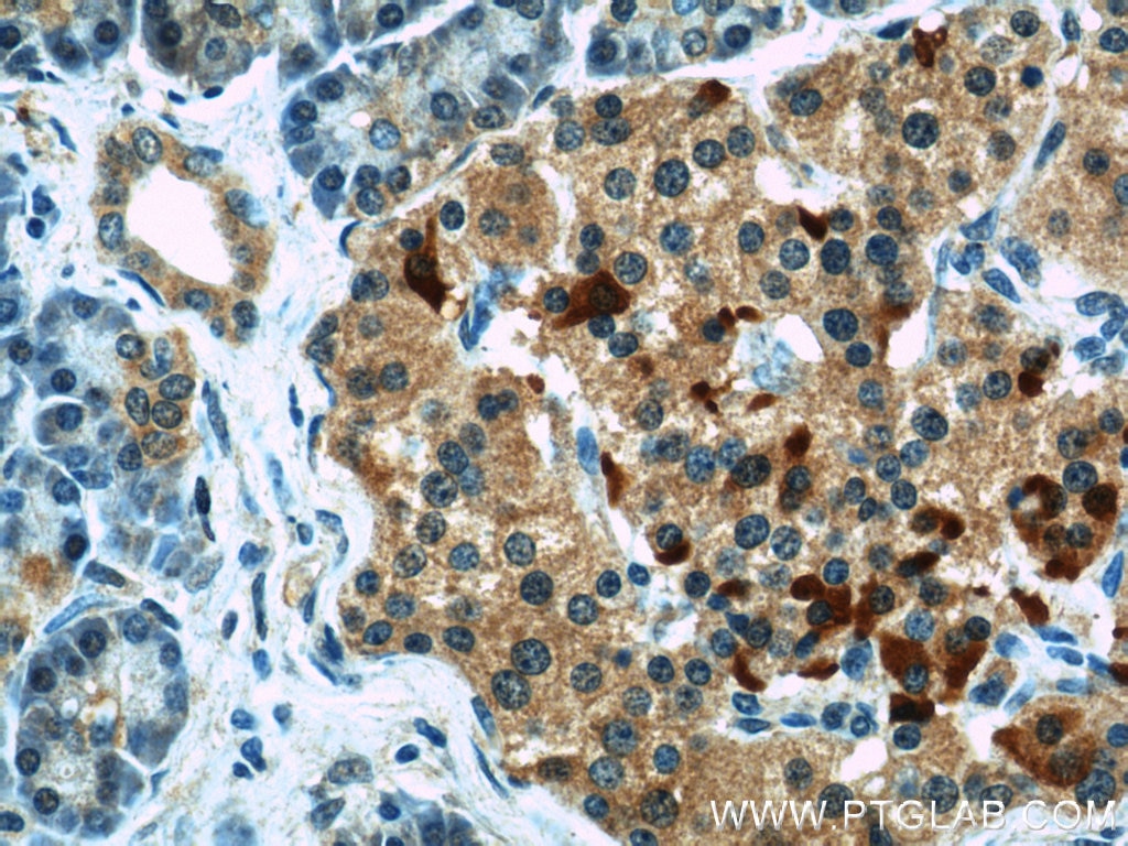 Immunohistochemistry (IHC) staining of human pancreas tissue using COL4A3BP Polyclonal antibody (15191-1-AP)