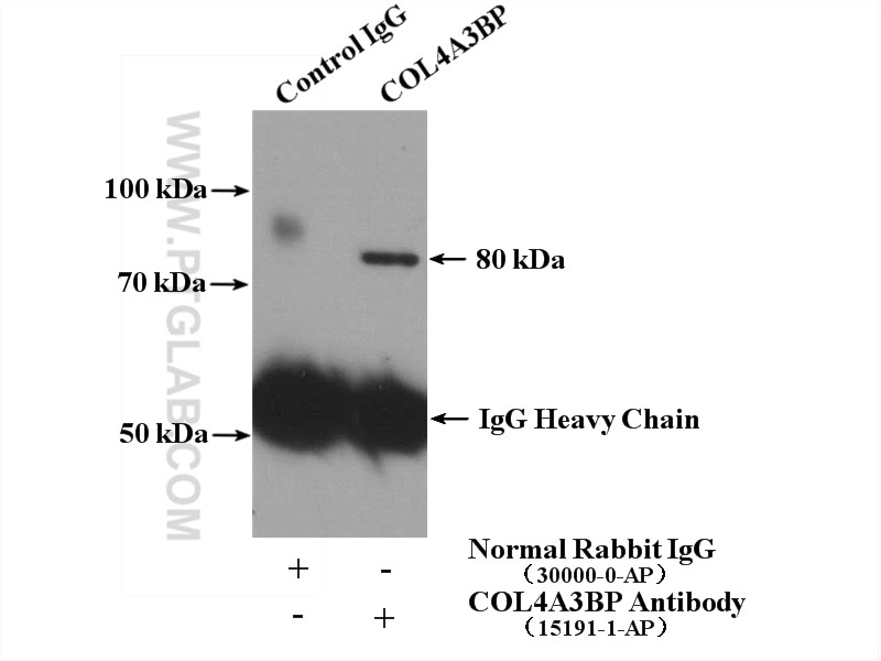 Immunoprecipitation (IP) experiment of mouse brain tissue using COL4A3BP Polyclonal antibody (15191-1-AP)