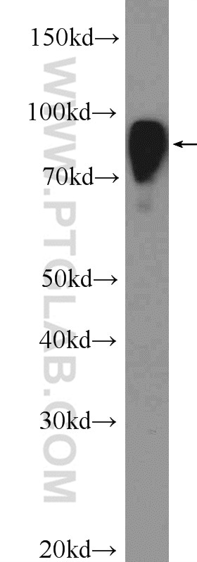 Western Blot (WB) analysis of rat brain tissue using COL4A3BP Polyclonal antibody (15191-1-AP)