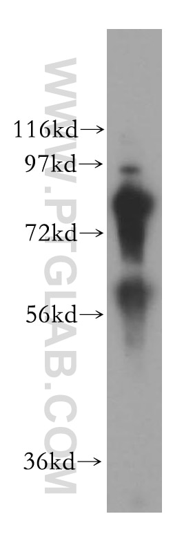 Western Blot (WB) analysis of human pancreas tissue using COL4A3BP Polyclonal antibody (15191-1-AP)