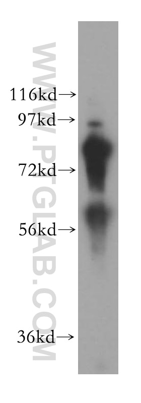 WB analysis of human pancreas using 15191-1-AP