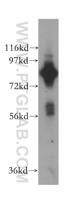 Western Blot (WB) analysis of HEK-293 cells using COL4A3BP Polyclonal antibody (15191-1-AP)