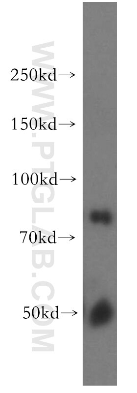 Western Blot (WB) analysis of mouse pancreas tissue using COL4A3BP Polyclonal antibody (15191-1-AP)