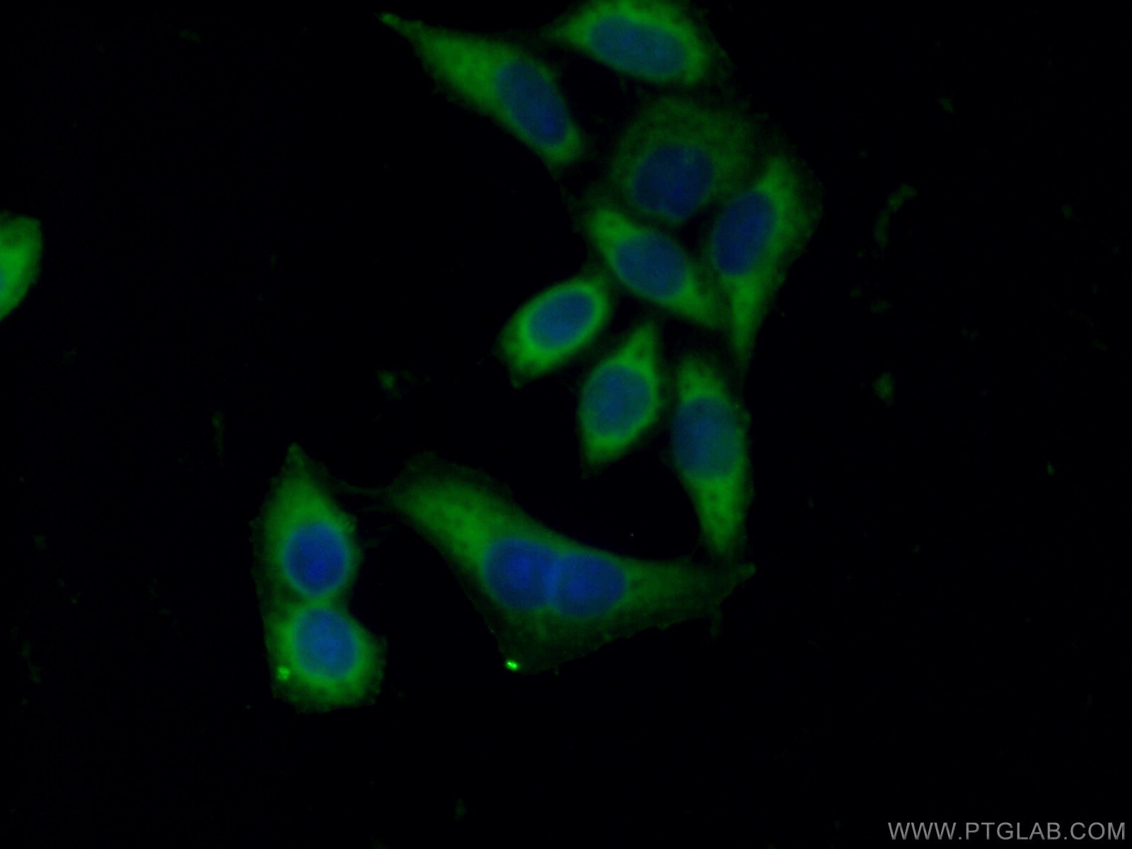 Immunofluorescence (IF) / fluorescent staining of HeLa cells using Collagen Type IV Polyclonal antibody (19674-1-AP)