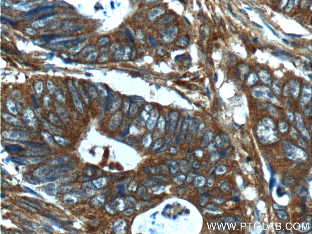 Collagen Type IV Polyclonal antibody