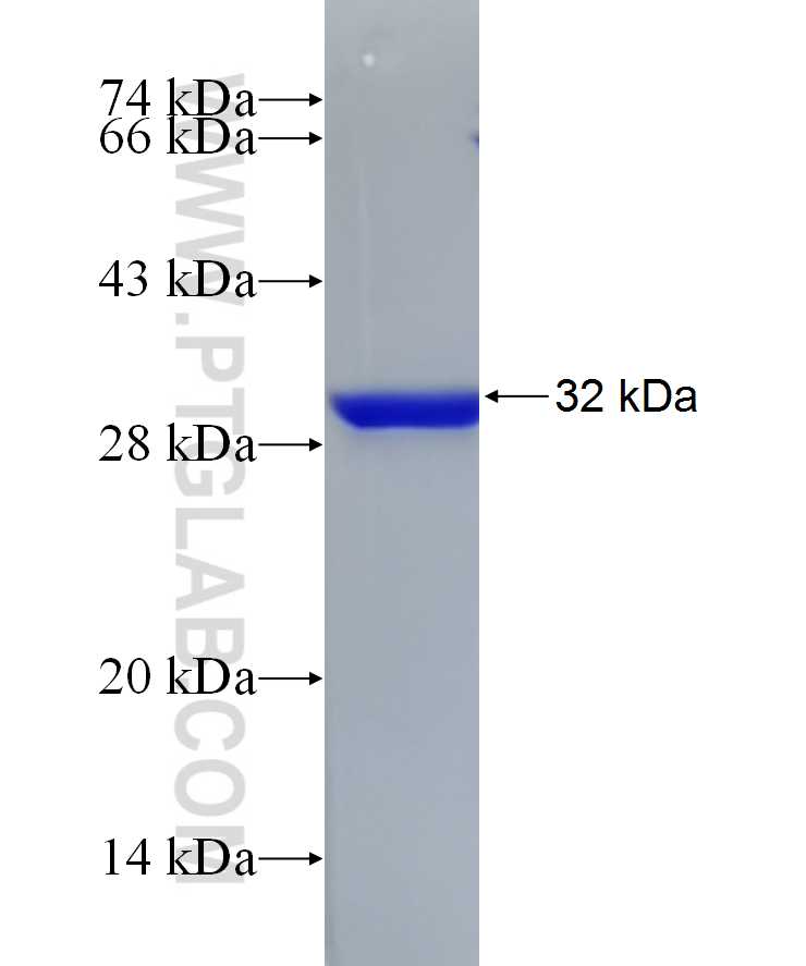 COL4A5 fusion protein Ag25084 SDS-PAGE