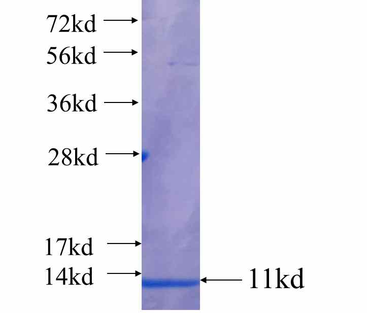 COL4A5 fusion protein Ag25105 SDS-PAGE