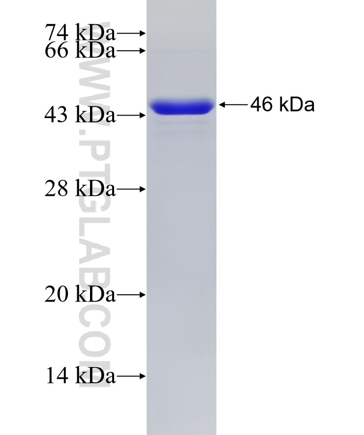 COL4A5 fusion protein Ag18799 SDS-PAGE