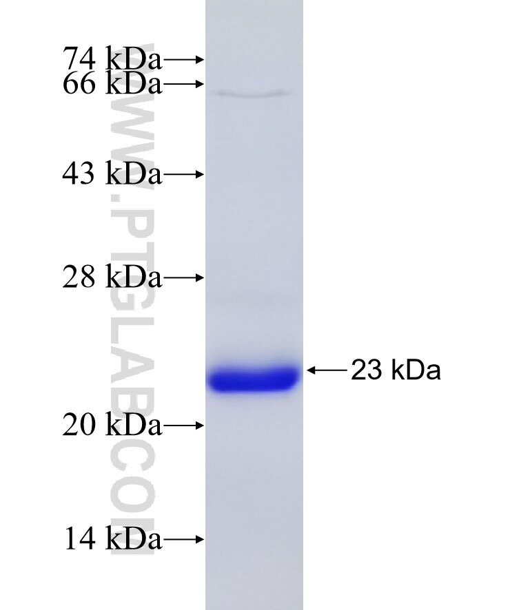 COL4A5 fusion protein Ag18947 SDS-PAGE