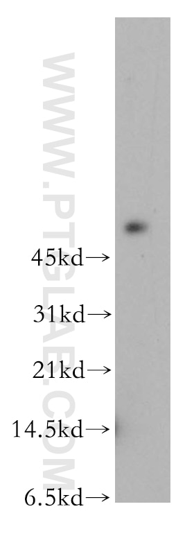 Collagen Type IV Polyclonal antibody