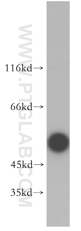 Western Blot (WB) analysis of SGC-7901 cells using Collagen Type IV Polyclonal antibody (10807-1-AP)