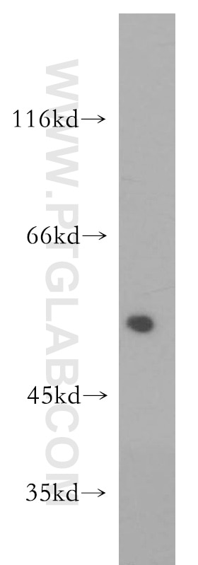 Western Blot (WB) analysis of A431 cells using Collagen Type IV Polyclonal antibody (10807-1-AP)