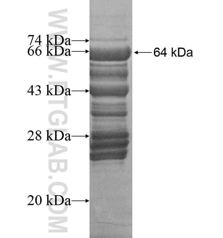 COL4A6 fusion protein Ag16640 SDS-PAGE