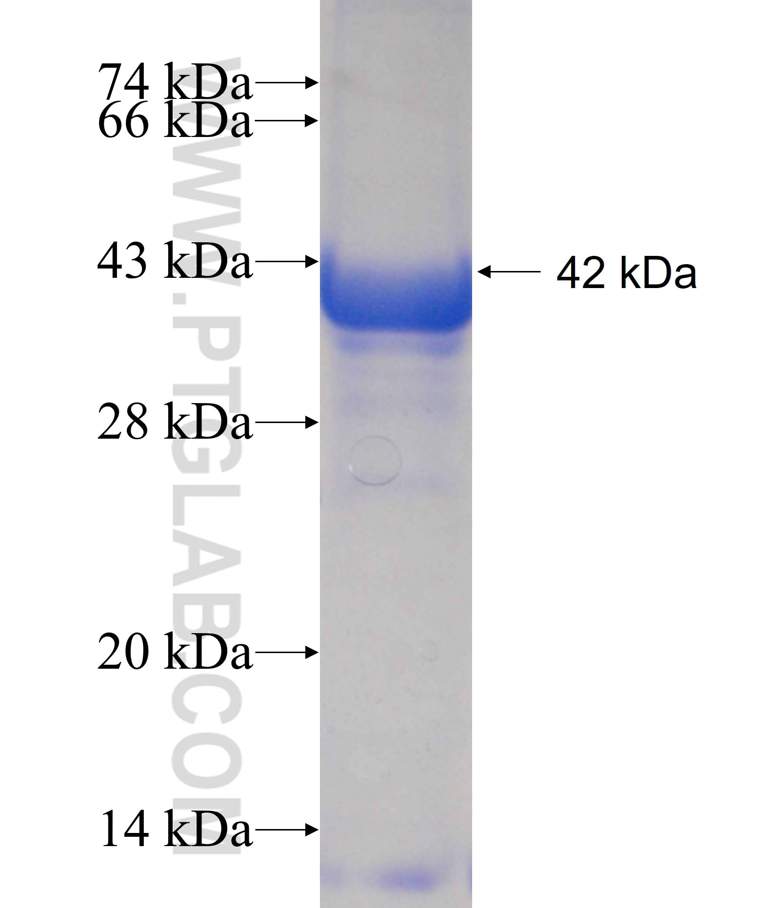 COL4A6 fusion protein Ag17428 SDS-PAGE