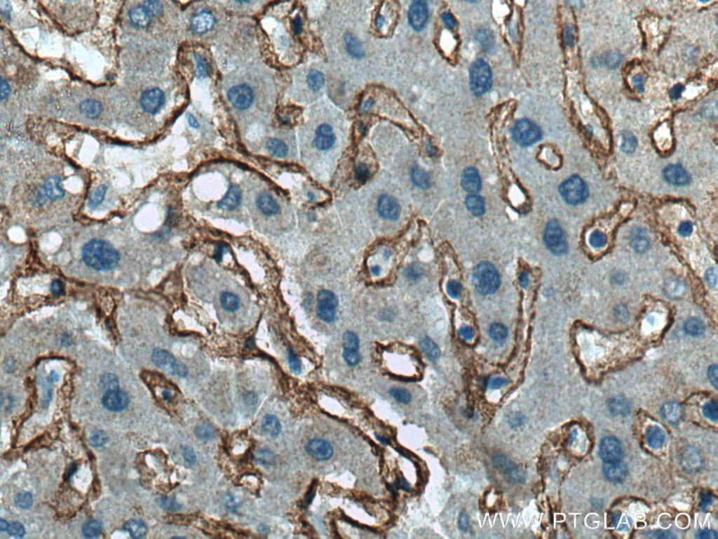 IHC staining of human liver using 17023-1-AP