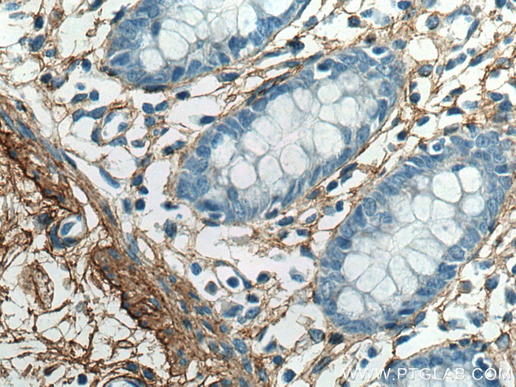 IHC staining of human colon using 17023-1-AP