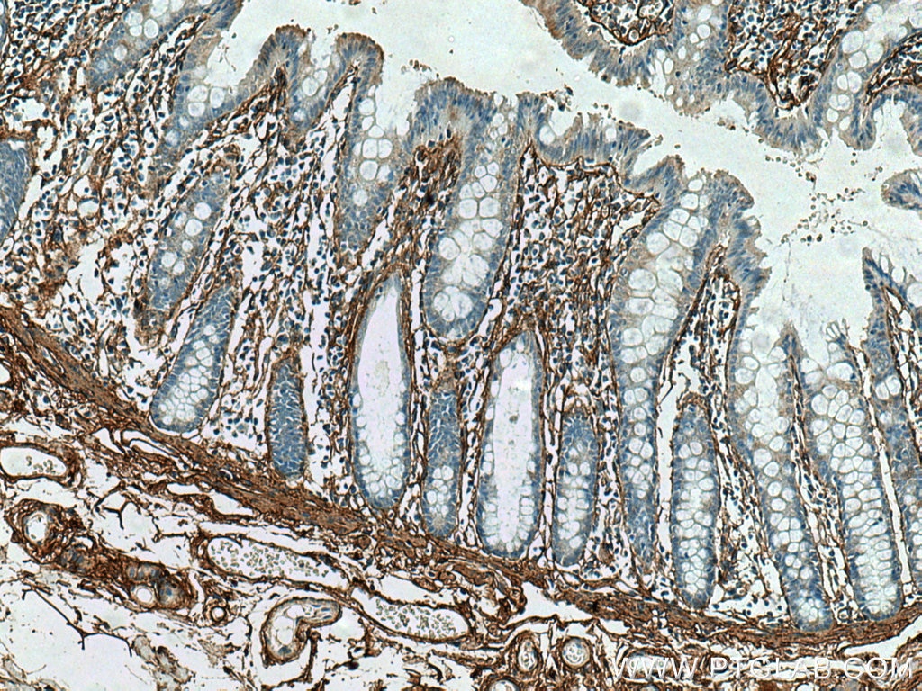 Immunohistochemistry (IHC) staining of human colon tissue using Collagen Type VI Polyclonal antibody (17023-1-AP)