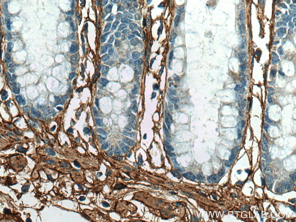 IHC staining of human colon using 17023-1-AP