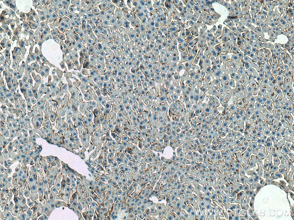 Immunohistochemistry (IHC) staining of mouse liver tissue using Collagen Type VI Polyclonal antibody (17023-1-AP)