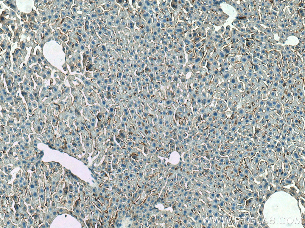 IHC staining of mouse liver using 17023-1-AP