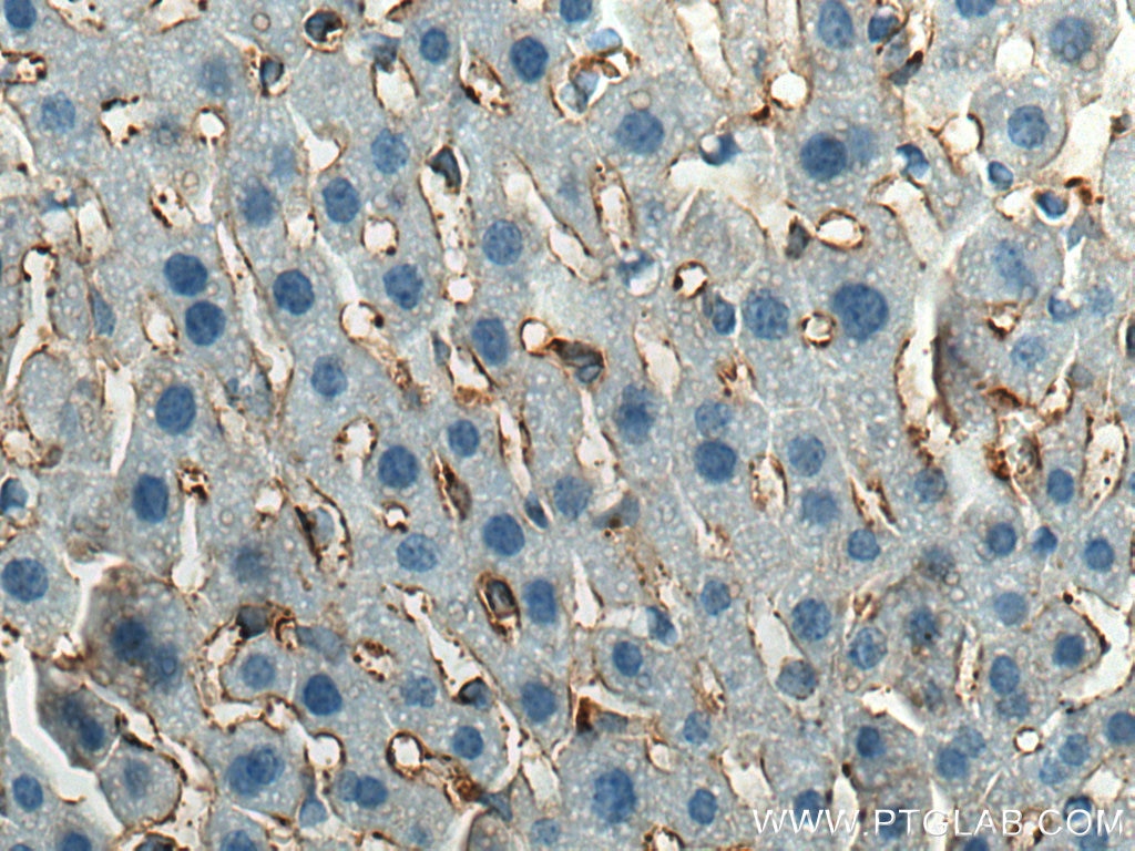 Immunohistochemistry (IHC) staining of mouse liver tissue using Collagen Type VI Polyclonal antibody (17023-1-AP)