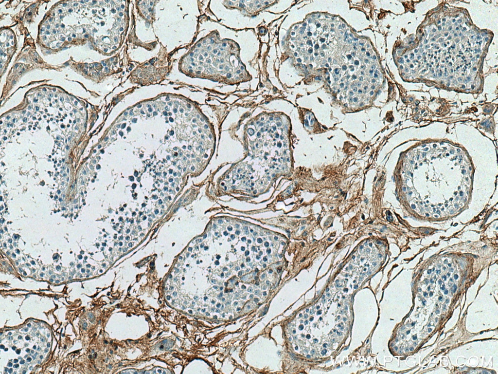 Immunohistochemistry (IHC) staining of human testis tissue using Collagen Type VI Polyclonal antibody (17023-1-AP)