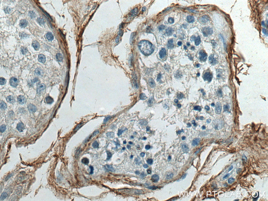 Immunohistochemistry (IHC) staining of human testis tissue using Collagen Type VI Polyclonal antibody (17023-1-AP)