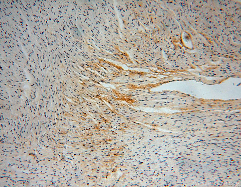 Immunohistochemistry (IHC) staining of human heart tissue using Collagen Type VI Polyclonal antibody (17023-1-AP)