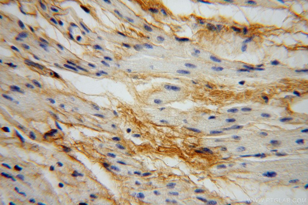 IHC staining of human heart using 17023-1-AP
