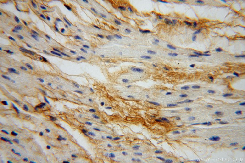 Immunohistochemistry (IHC) staining of human heart tissue using Collagen Type VI Polyclonal antibody (17023-1-AP)