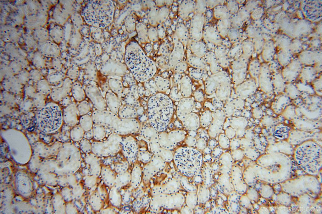 Immunohistochemistry (IHC) staining of human kidney tissue using Collagen Type VI Polyclonal antibody (17023-1-AP)