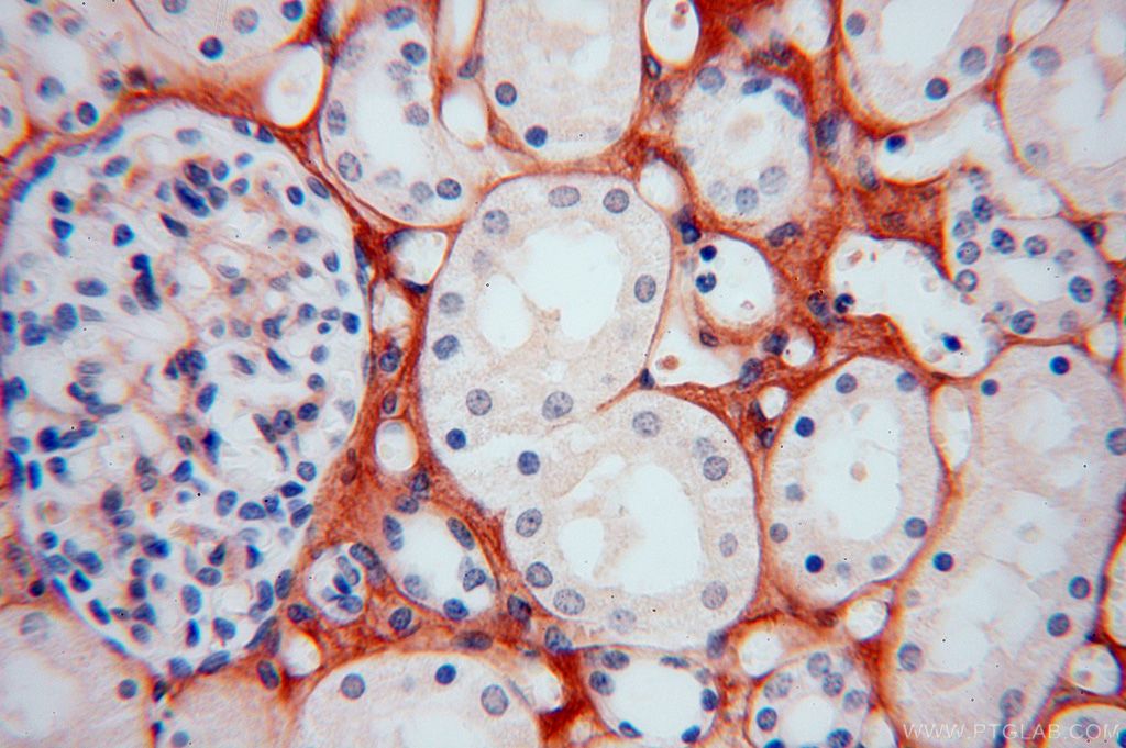 IHC staining of human kidney using 17023-1-AP