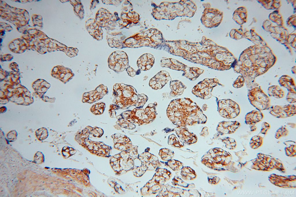 Immunohistochemistry (IHC) staining of human placenta tissue using Collagen Type VI Polyclonal antibody (17023-1-AP)