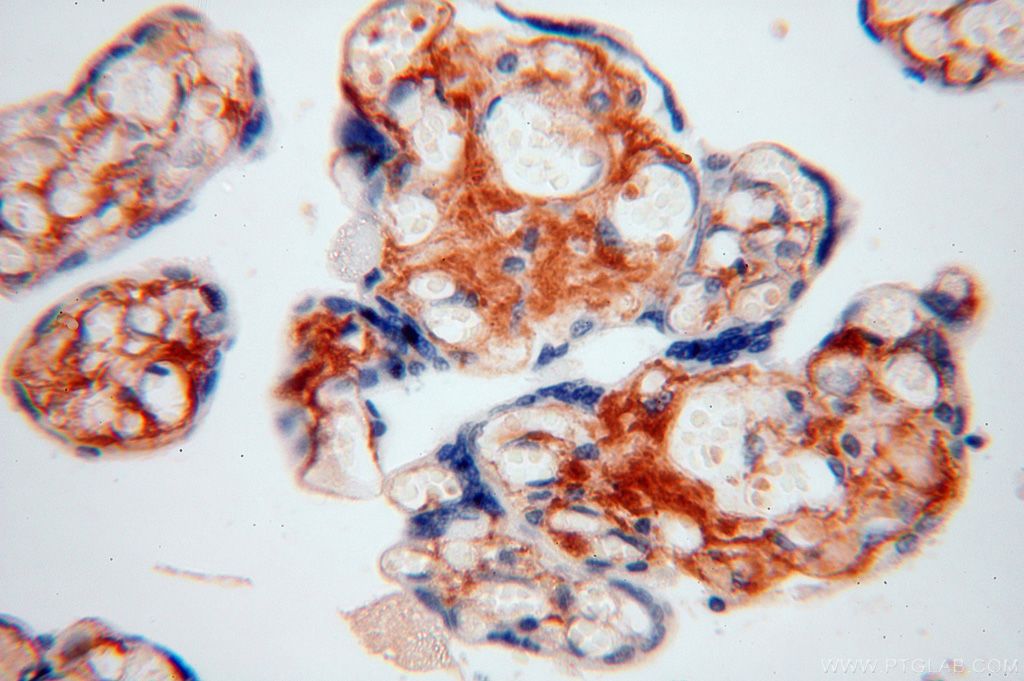IHC staining of human placenta using 17023-1-AP