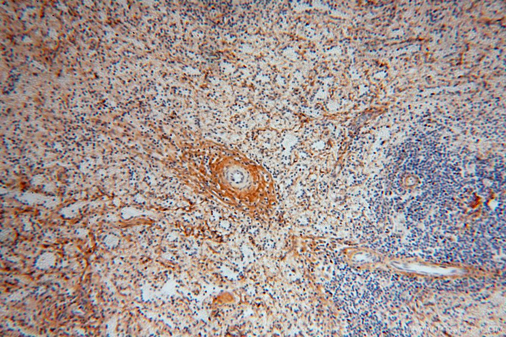 Immunohistochemistry (IHC) staining of human spleen tissue using Collagen Type VI Polyclonal antibody (17023-1-AP)