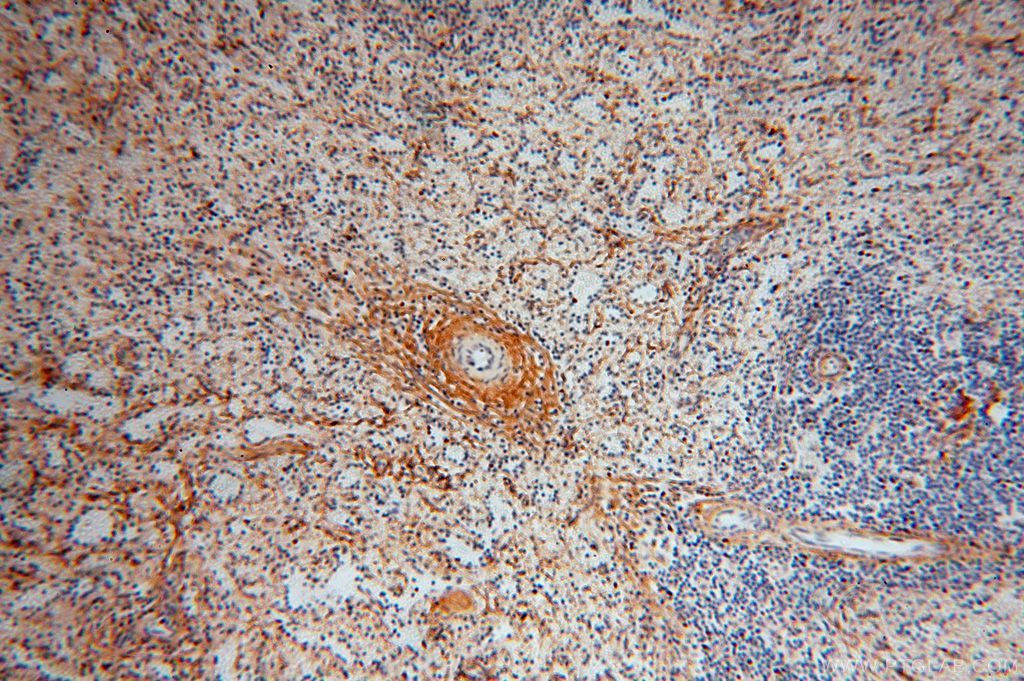 IHC staining of human spleen using 17023-1-AP