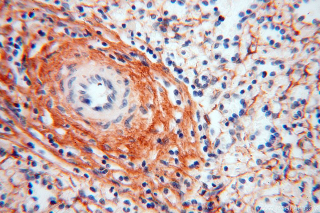 Immunohistochemistry (IHC) staining of human spleen tissue using Collagen Type VI Polyclonal antibody (17023-1-AP)