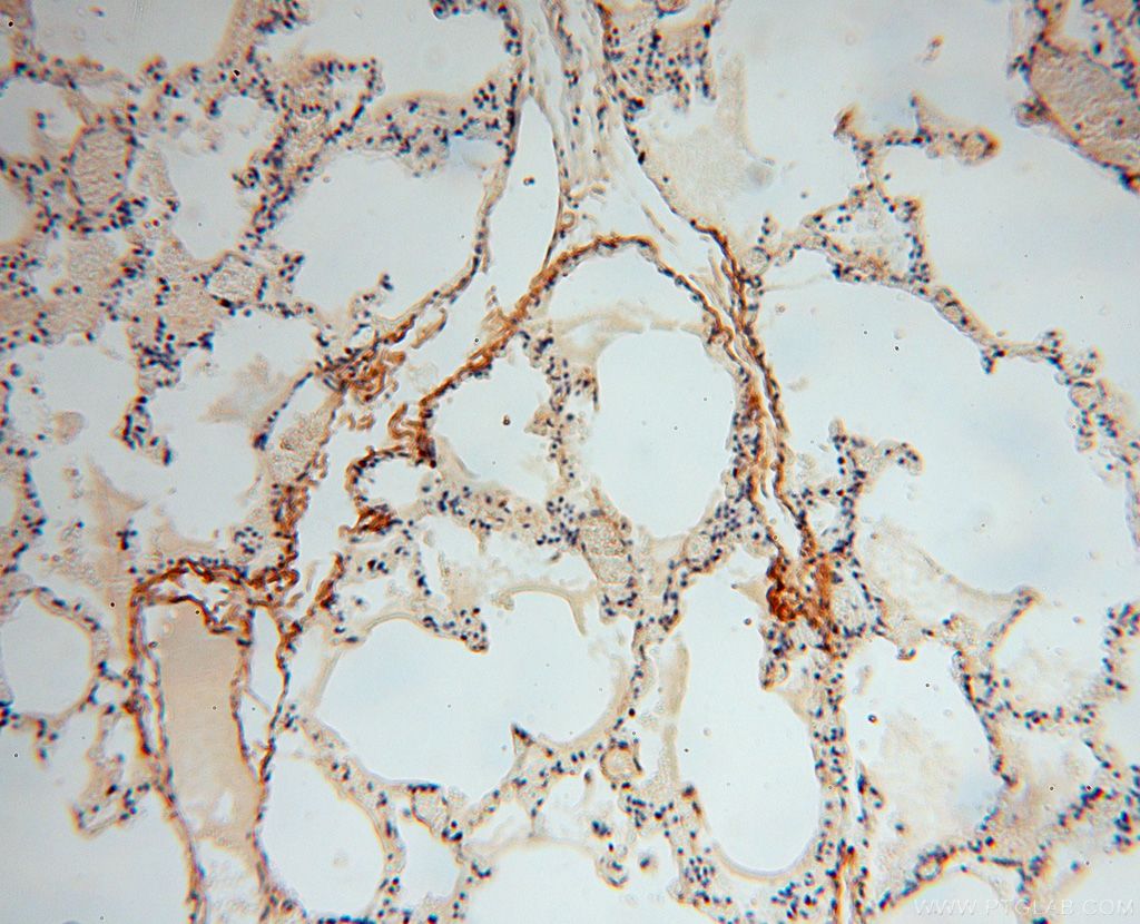 IHC staining of human lung using 17023-1-AP