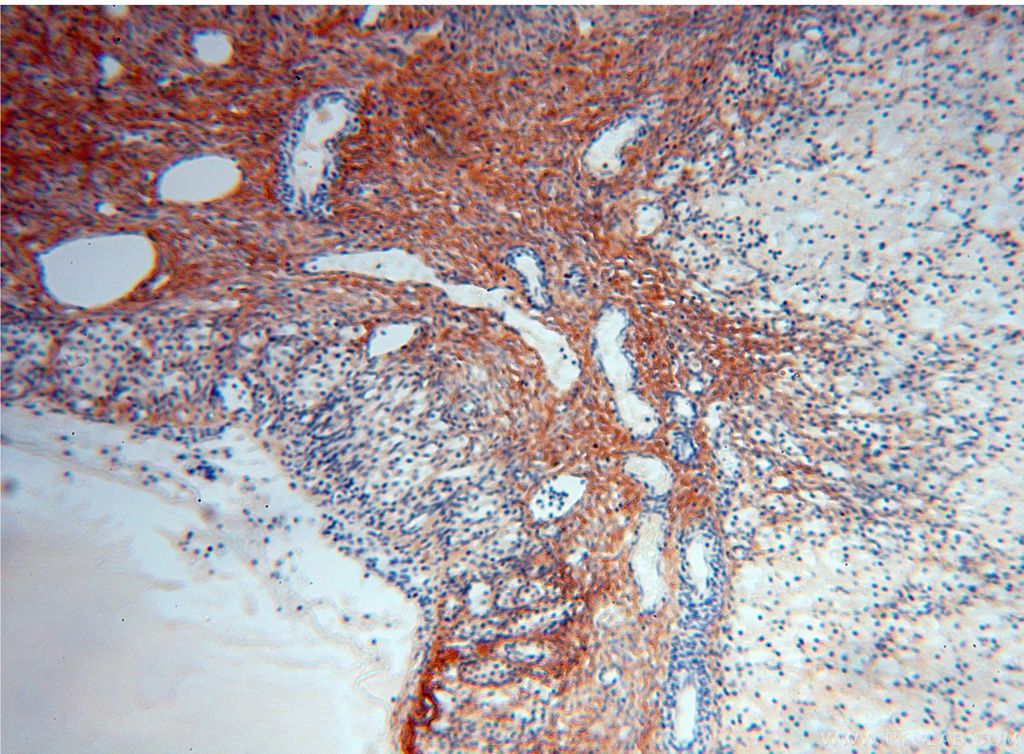 Immunohistochemistry (IHC) staining of human ovary tissue using Collagen Type VI Polyclonal antibody (17023-1-AP)