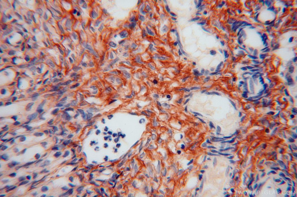 Immunohistochemistry (IHC) staining of human ovary tissue using Collagen Type VI Polyclonal antibody (17023-1-AP)