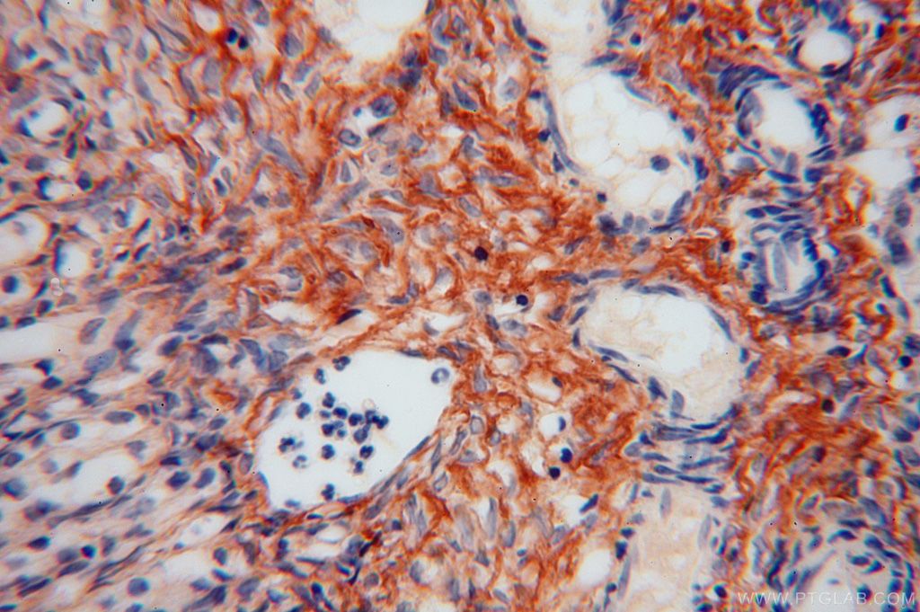 IHC staining of human ovary using 17023-1-AP