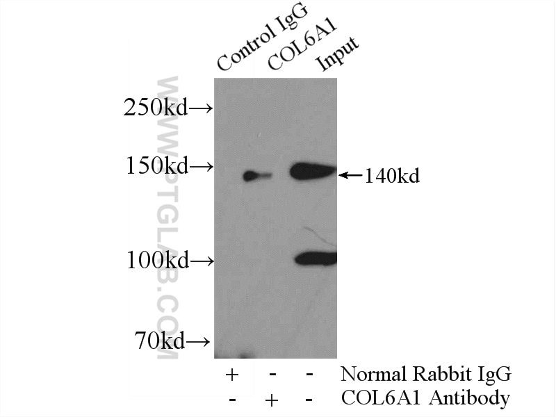 Immunoprecipitation (IP) experiment of mouse heart tissue using Collagen Type VI Polyclonal antibody (17023-1-AP)