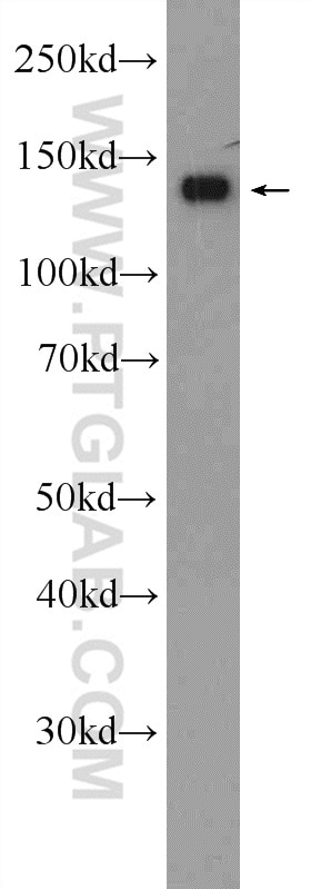 Western Blot (WB) analysis of human heart tissue using Collagen Type VI Polyclonal antibody (17023-1-AP)