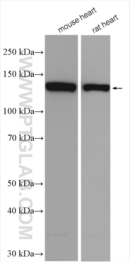 Western Blot (WB) analysis of various lysates using Collagen Type VI Polyclonal antibody (17023-1-AP)