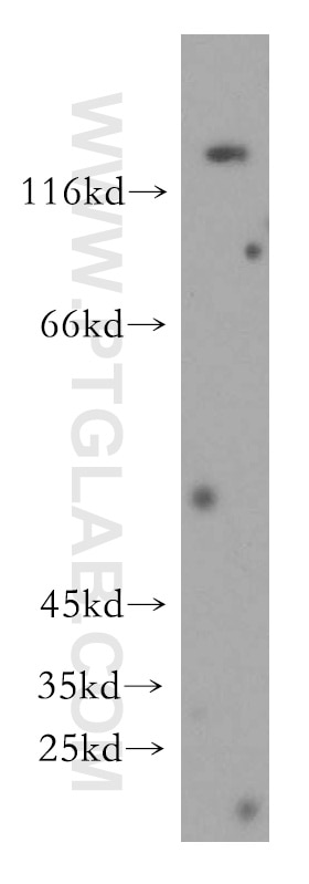 Western Blot (WB) analysis of human skeletal muscle tissue using Collagen Type VI Polyclonal antibody (17023-1-AP)